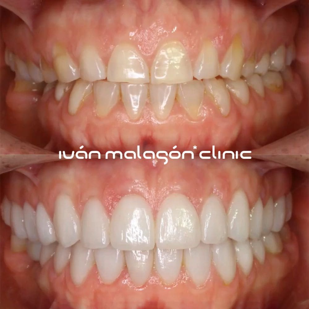 Clinica dental y diseno de sonrisa Ivan Malagón Clinic – Madrid – Barrio Salamanca – Milla de Oro – imagen 6